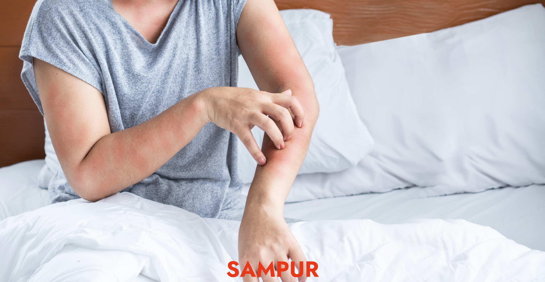 Punaises de lit : comment les éviter ?